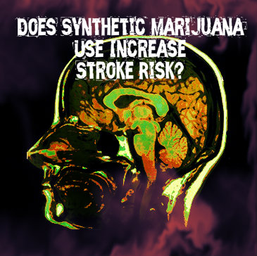 Synthetic Marijuana Use Increases Stroke Risk | Spice Side Effects